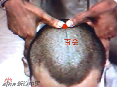 艾灸常用的保健穴有哪些？--百會(huì)