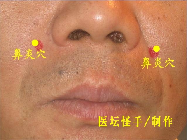 王文遠(yuǎn)平衡針灸穴位圖 - 3396815 - 3396815博愛(ài)