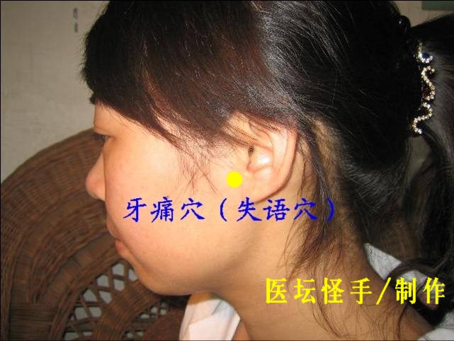 王文遠(yuǎn)平衡針灸穴位圖 - 3396815 - 3396815博愛(ài)